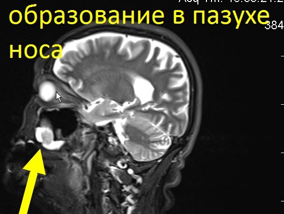 Онкоскрининг всего тела