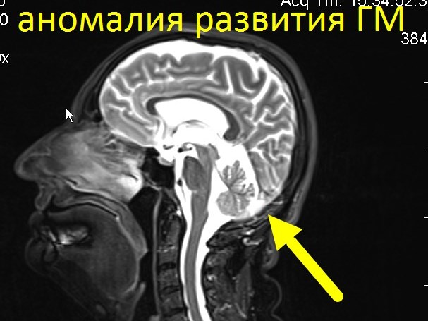 Онкоскрининг всего тела