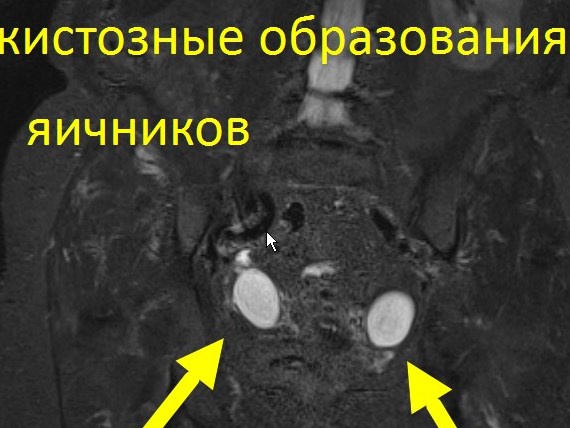 Онкоскрининг всего тела