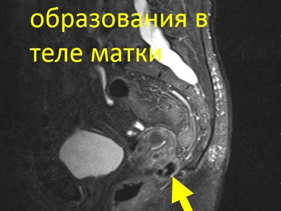 Онкоскрининг всего тела