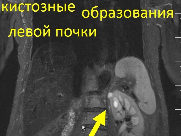 Онкоскрининг всего тела