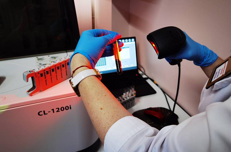 Исследование уровня лютеинизируещего гормона в сыворотке крови ЛГ (ИХЛА)