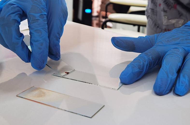 Общий (клинический) анализ крови +  исследование уровня тромбоцитов  в крови по Фонио (вручную)