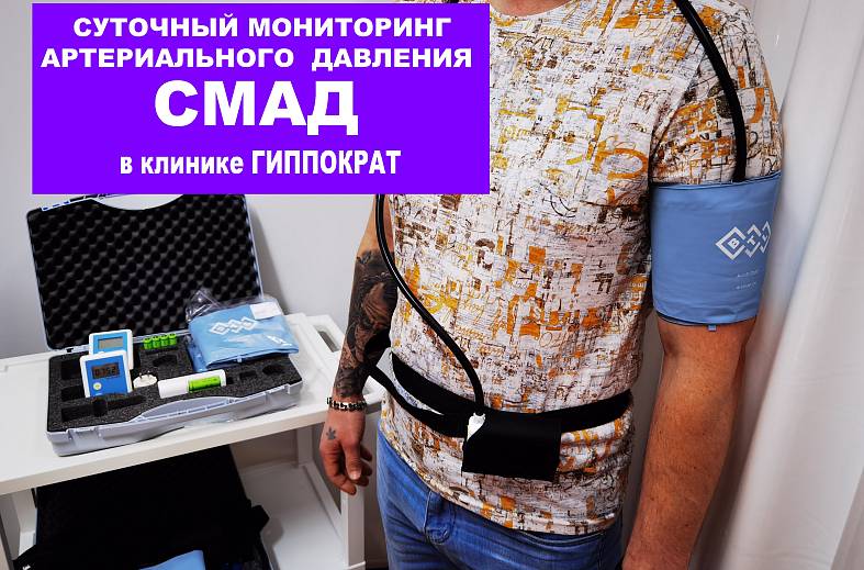 Суточное мониторирование артериального давления (СМАД)