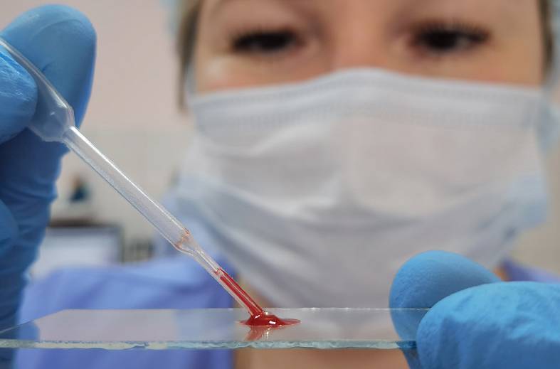 Общий (клинический) анализ крови +  исследование уровня тромбоцитов  в крови по Фонио (вручную)