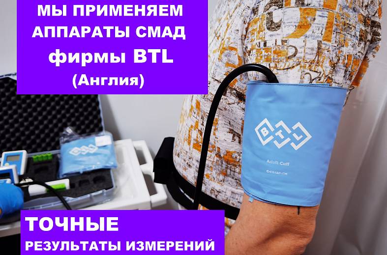 Суточное мониторирование артериального давления (СМАД)