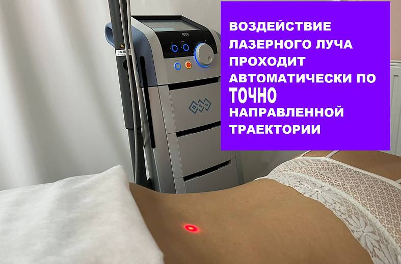 Автоматизированная лазерная терапия (РЛВИ) высокой интенсивности с роботизированной системой сканирования  