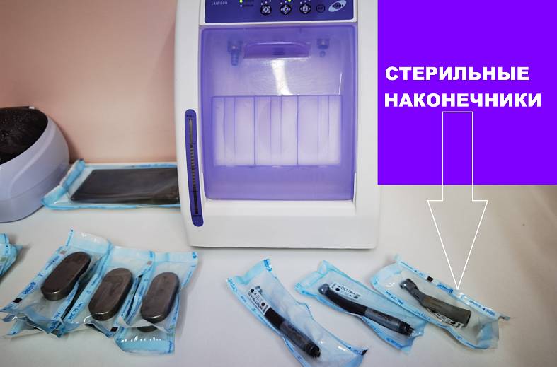 Лечение пульпита