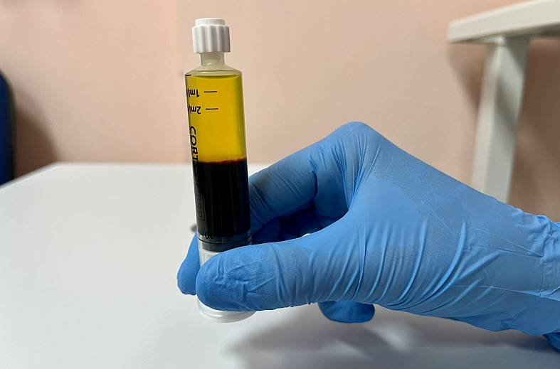 PRP (Cortexil) 2 зоны 1 процедура (2 пробирки) для лечения суставов