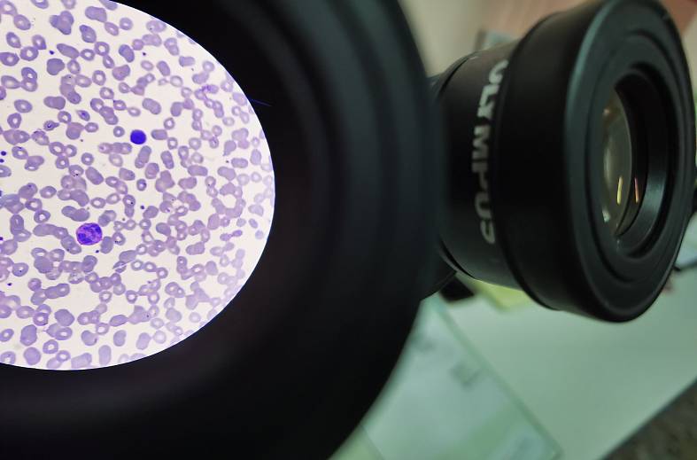 Общий (клинический) анализ крови +  исследование уровня тромбоцитов  в крови по Фонио (вручную)