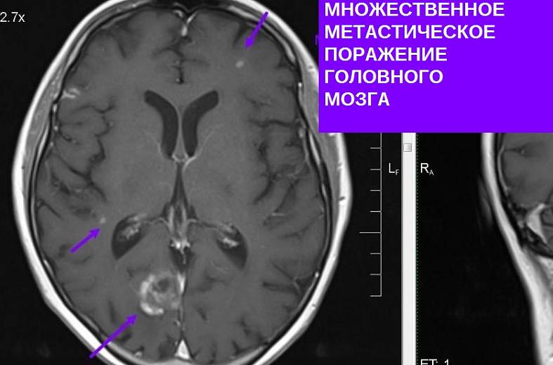 МРТ головного мозга (обзорное)