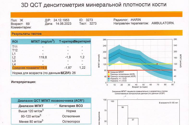 КТ Остео-денситометрия поясничного отдела позвоночника (измерение плотности костей в поясничном отделе позвоночника)