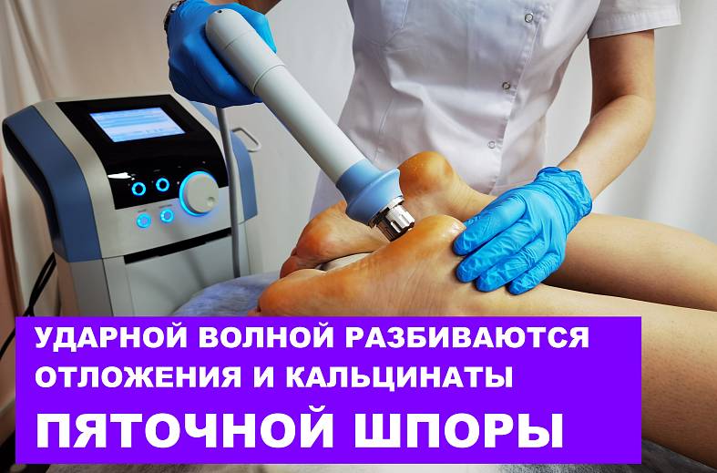Ударно-волновая терапия радиальная при грудном остеохондрозе
