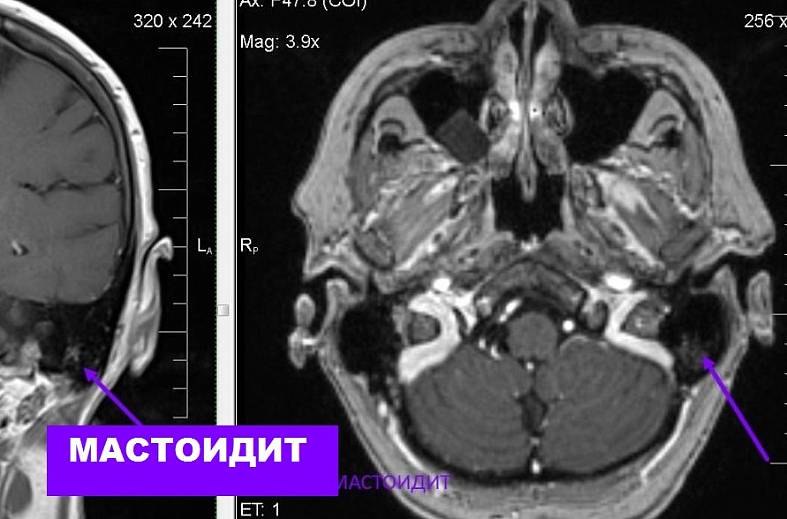 МРТ головного мозга (обзорное)