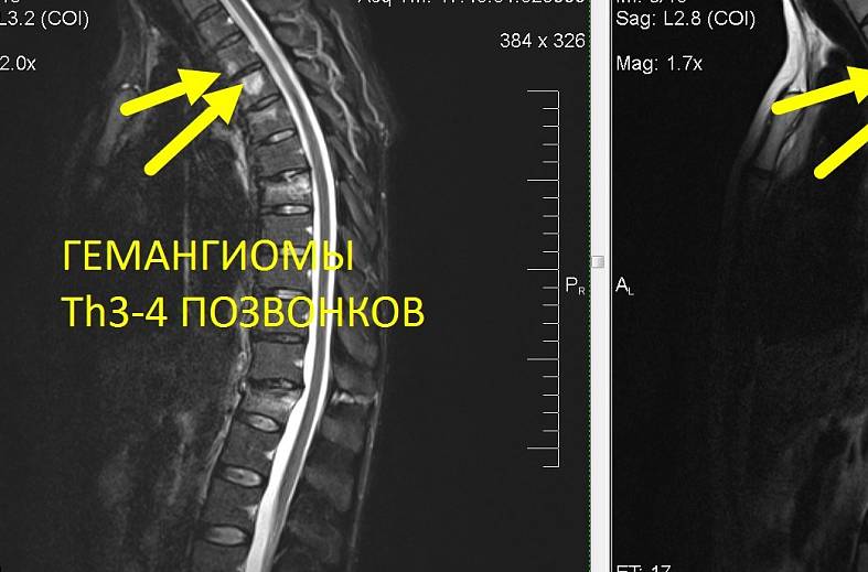 МРТ всего позвоночника (осмотр по ТИМ технологии)