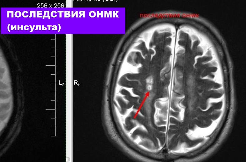 МРТ головного мозга (обзорное)