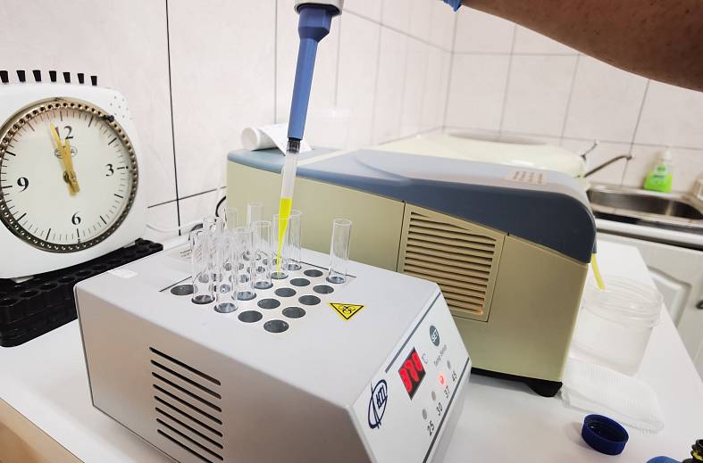 Определение активности (диастазы) альфа-амилазы в моче  