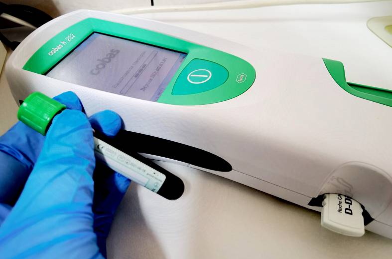 Определение концентрации Д-димера в крови