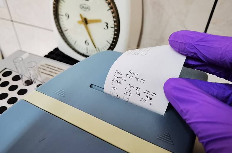 Определение активности (диастазы) альфа-амилазы в моче  