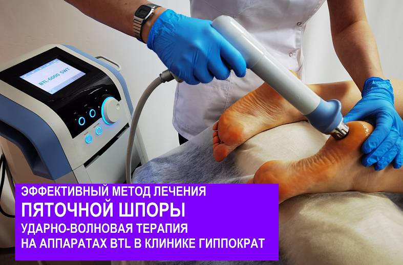 Ударно-волновая терапия радиальная при грудном остеохондрозе