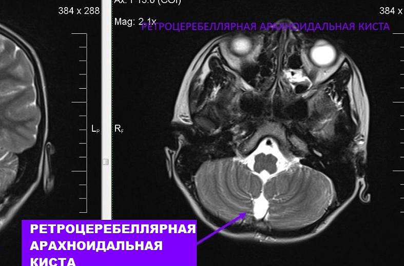МРТ головного мозга (обзорное)