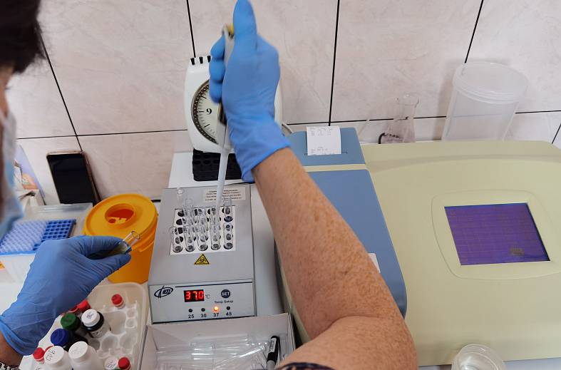 Проба Реберга-Тареева