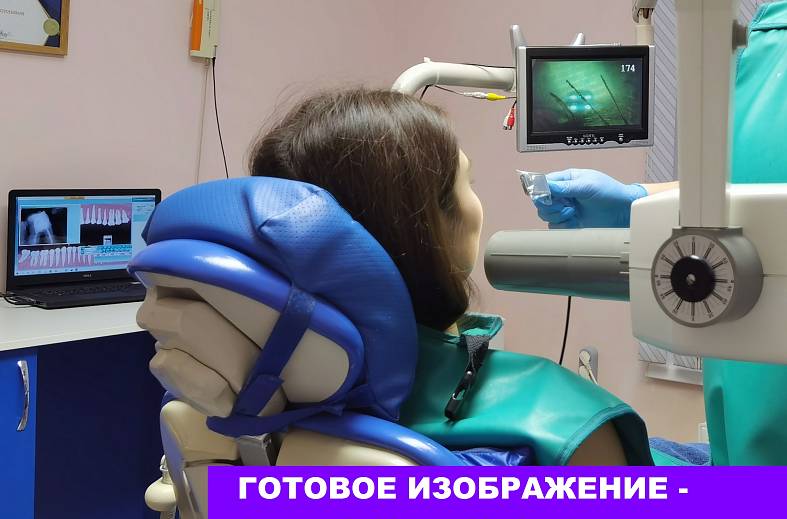 Снимок зуба - визиограмма