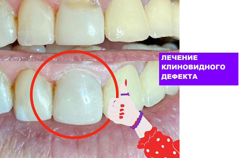 Первичный прием стоматолога с диагностикой интраоральной видеокамерой