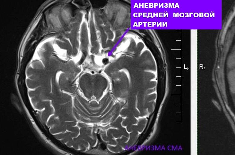 МРТ головного мозга (обзорное)