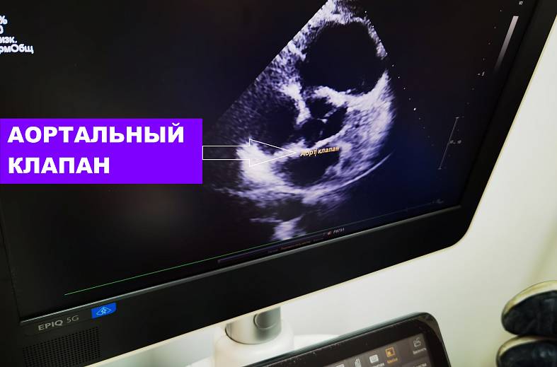 Дуплексное/триплексное сканирование аорты