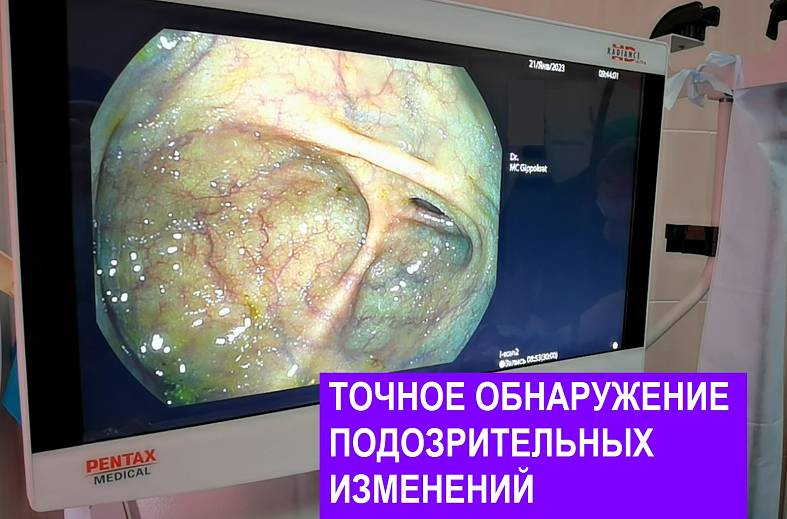 Видеоколоноскопия экспертного класса на аппарате Pentax i7010 (Япония) expert