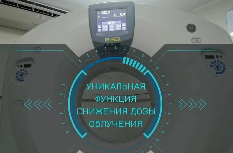 КТ лучезапястного сустава