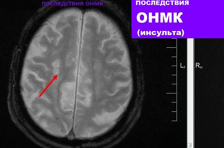 МРТ головного мозга (обзорное)