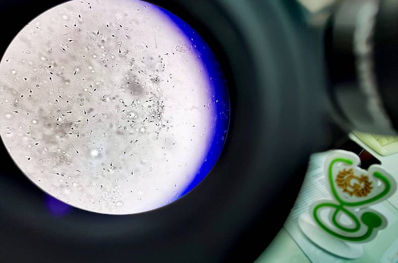 Спермограмма по Крюгеру