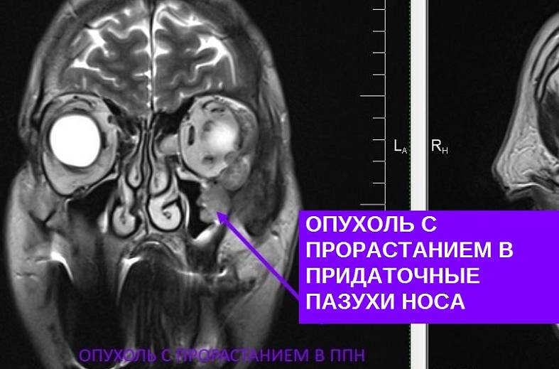 МРТ головного мозга (обзорное)