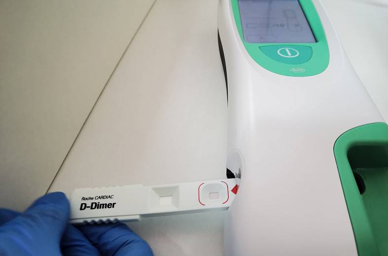 Определение концентрации Д-димера в крови