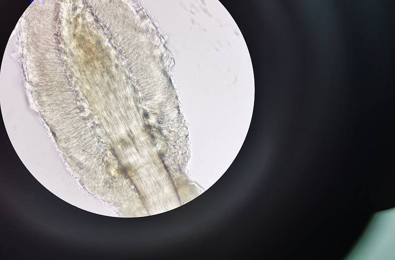 Обследование и забор материала на Демодекоз (Demodex)