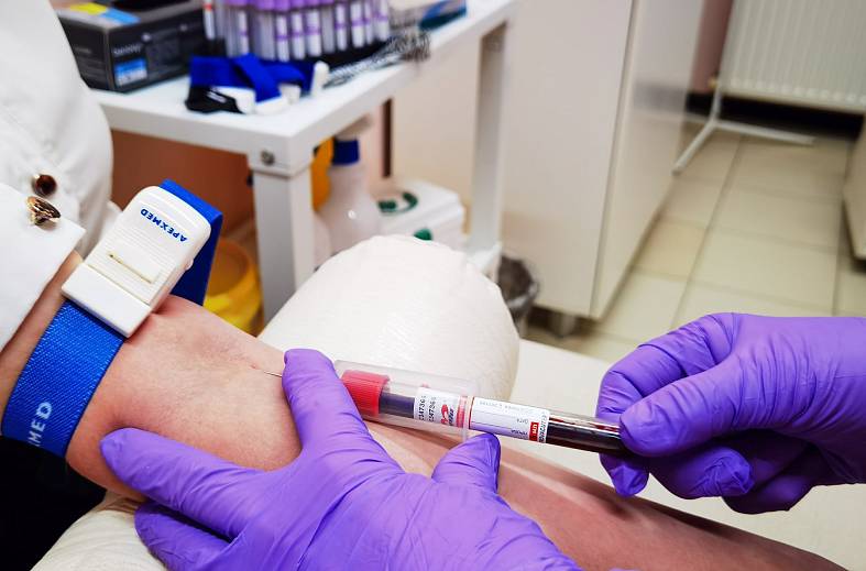 Определение активности гаммаглютамилтрансферазы в крови (ГГТ)