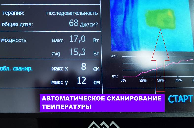 Автоматизированная лазерная терапия (РЛВИ) высокой интенсивности с роботизированной системой сканирования  