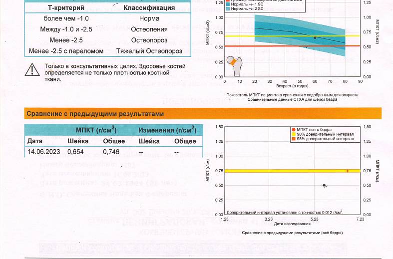 КТ Остео-денситометрия бедренной кости (измерение плотности бедренной кости)