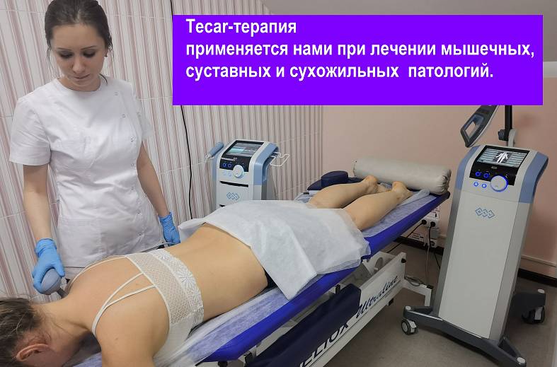 TECAR-терапия контактная направленная диатермия    