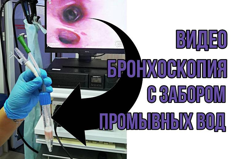 Видео трахеобронхоскопия с забором промывных вод на флору и грибы