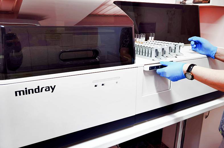 Исследование уровня лютеинизируещего гормона в сыворотке крови ЛГ (ИХЛА)