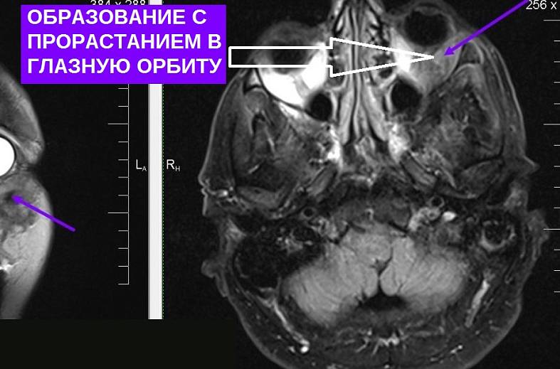 МРТ головного мозга (обзорное)