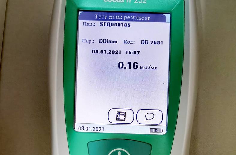 Определение концентрации Д-димера в крови