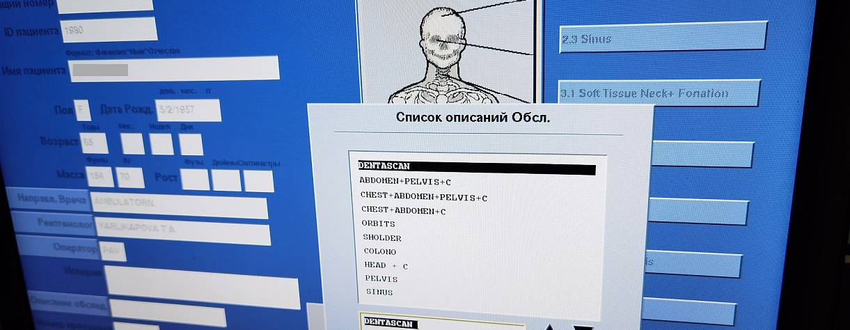 КТ зубов