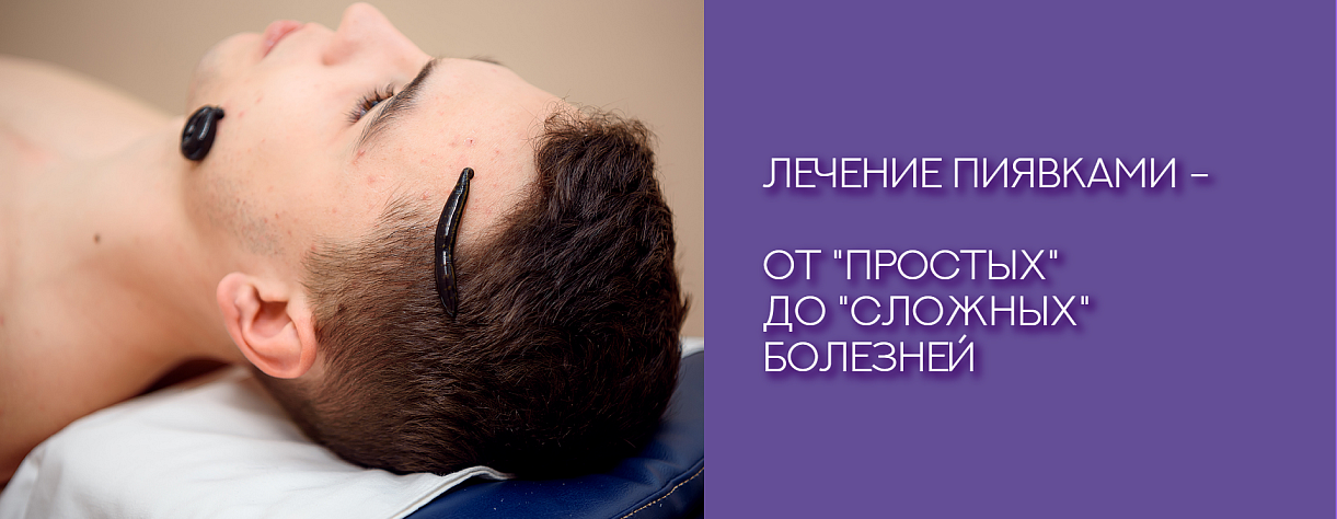 Гирудотерапия